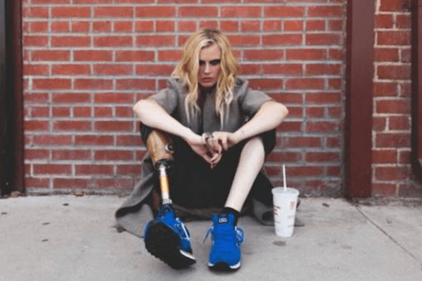 Lauren Wasser, mannequin, a été victime du SCT (Syndrome du choc toxique) et a perdu une jambe.