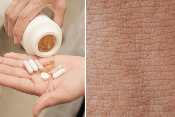 Complément alimentaire peau sèche ménopause