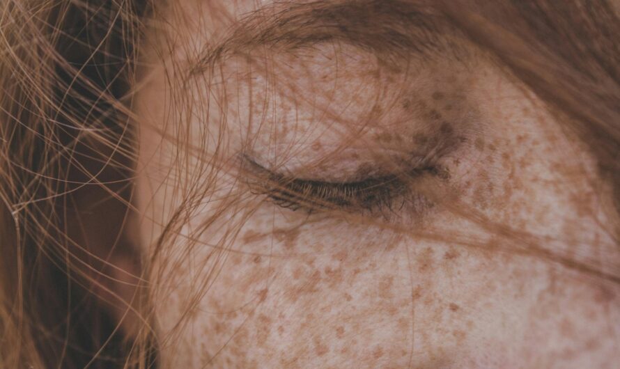 Excès Sébum Visage : 7 Remèdes Naturels Efficaces