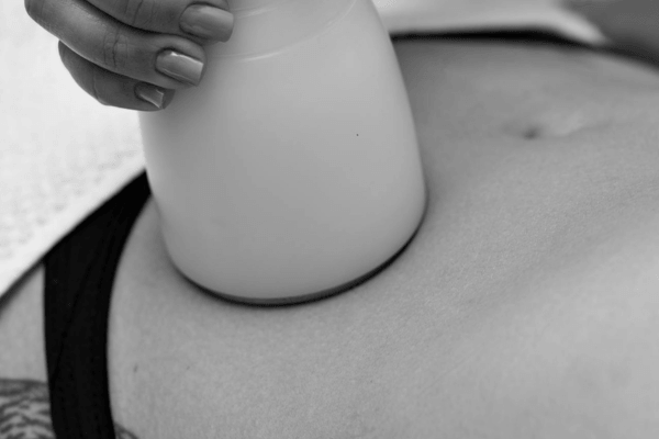 Cryolipolyse : le guide honnête pour comprendre, évaluer et décider