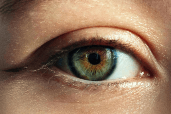 Paupière supérieure gonflée et tombante : ce que ça signifie vraiment (et quoi faire)