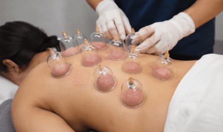 Cupping therapy
