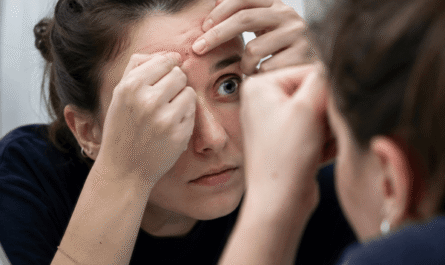 Dermatillomanie